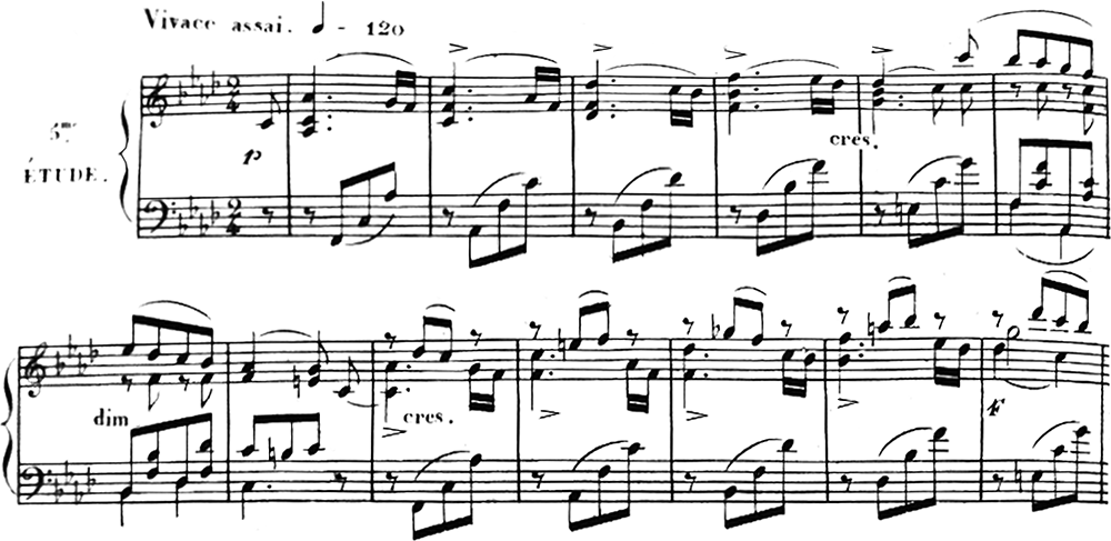 C. チェルニー24の《性格的大練習曲》作品692, 第1巻, 第5番〈心の動揺〉, 第1～13小節